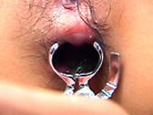 Ass Stretching Creampie
