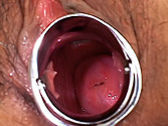 Gyno Exam Pussy Opened Wide